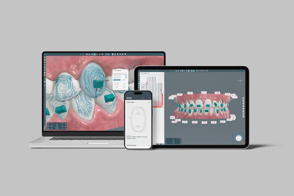 The VISION software includes a number of automated features, including Phantom for force visualization, BiteControl for analyzing occlusion and jaw displacement, and Staging Prime for informed movement sequencing.