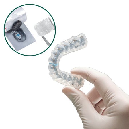 Solventum APC Flash-Free Adhesive with Clarity Digital Bonding