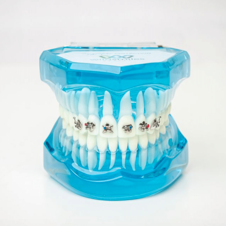 WildSmiles Designer Brackets