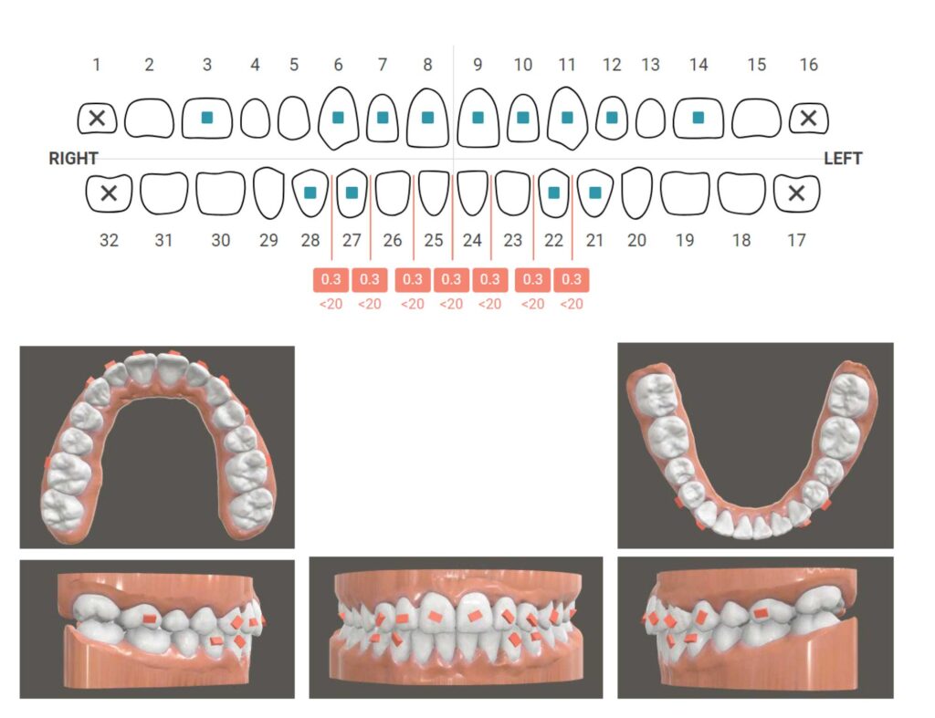 Figure 5. Digital Treatment Plan.