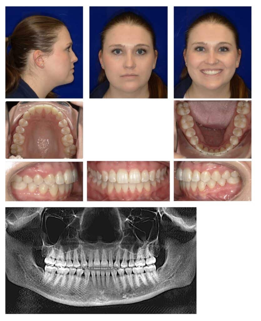 Figure 8. Final results demonstrating that all treatment goals were met.