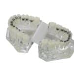 The Story Behind the Orthodontist Who Saved a Lingual Braces Technology