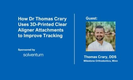 How Dr Thomas Crary Uses 3D-Printed Clear Aligner Attachments to Improve Tracking