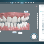 SoftSmile Debuts Vision Concierge AI for Orthodontic Software