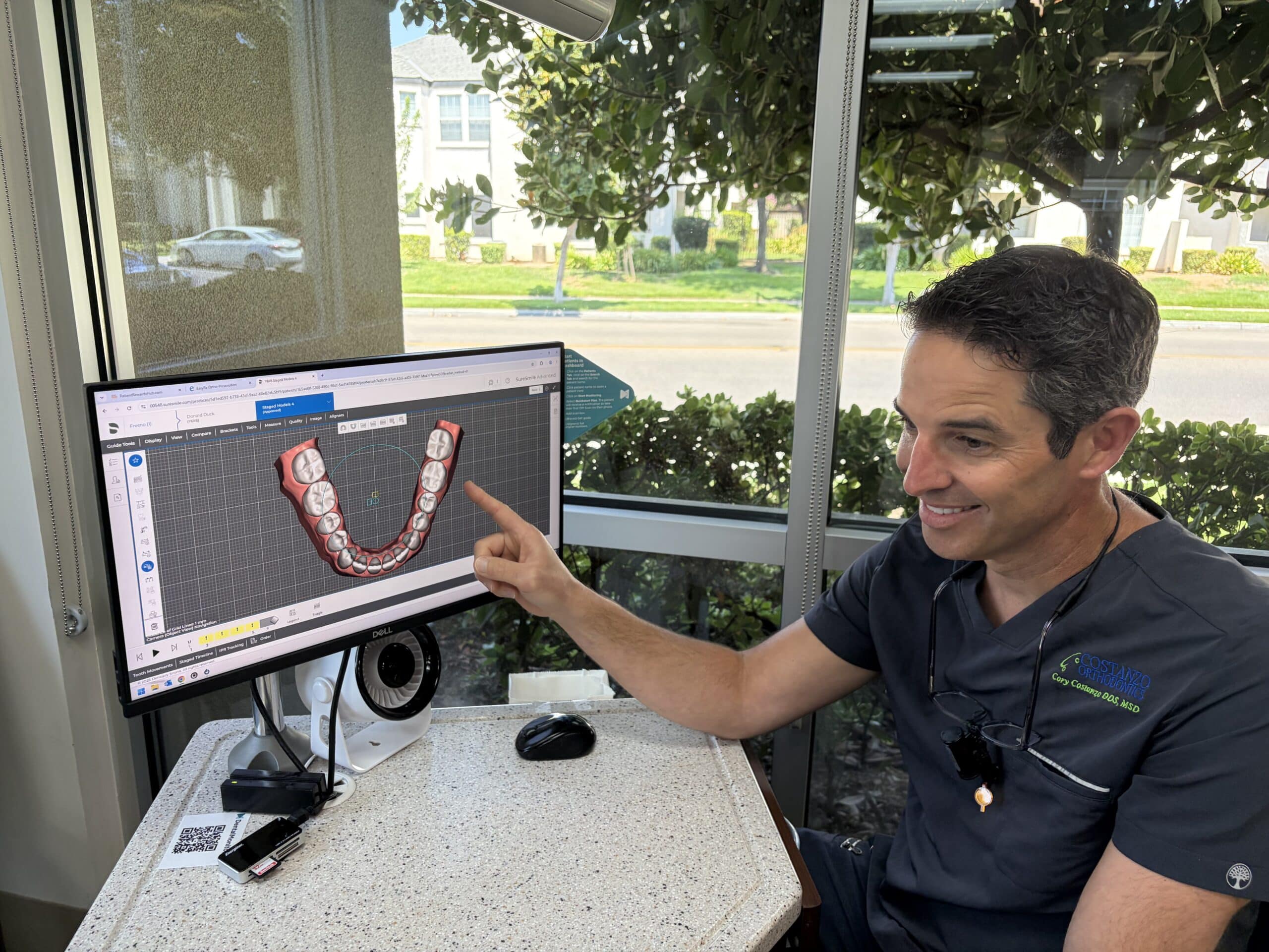 From Hesitation to Confidence: How SureSmile Changed My Approach to Complex Aligner Cases