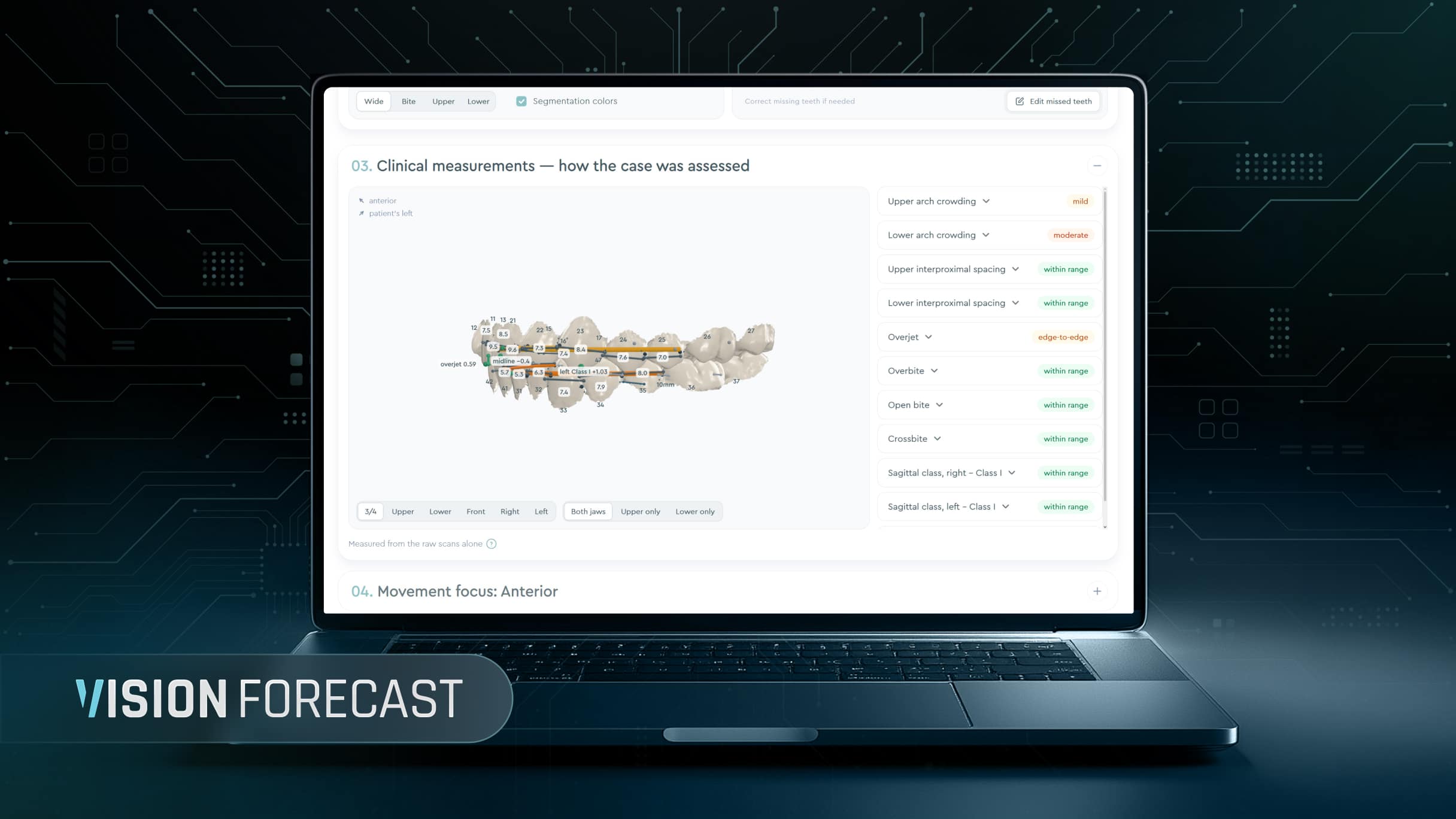 SoftSmile Debuts AI Treatment Forecast Tool